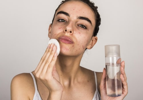 Sun Protection for Acne-Prone Skin: How to Keep Your Skin Clear and Healthy